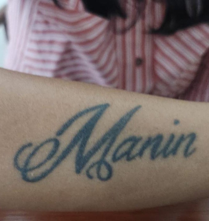 Before — laser tattoo removal