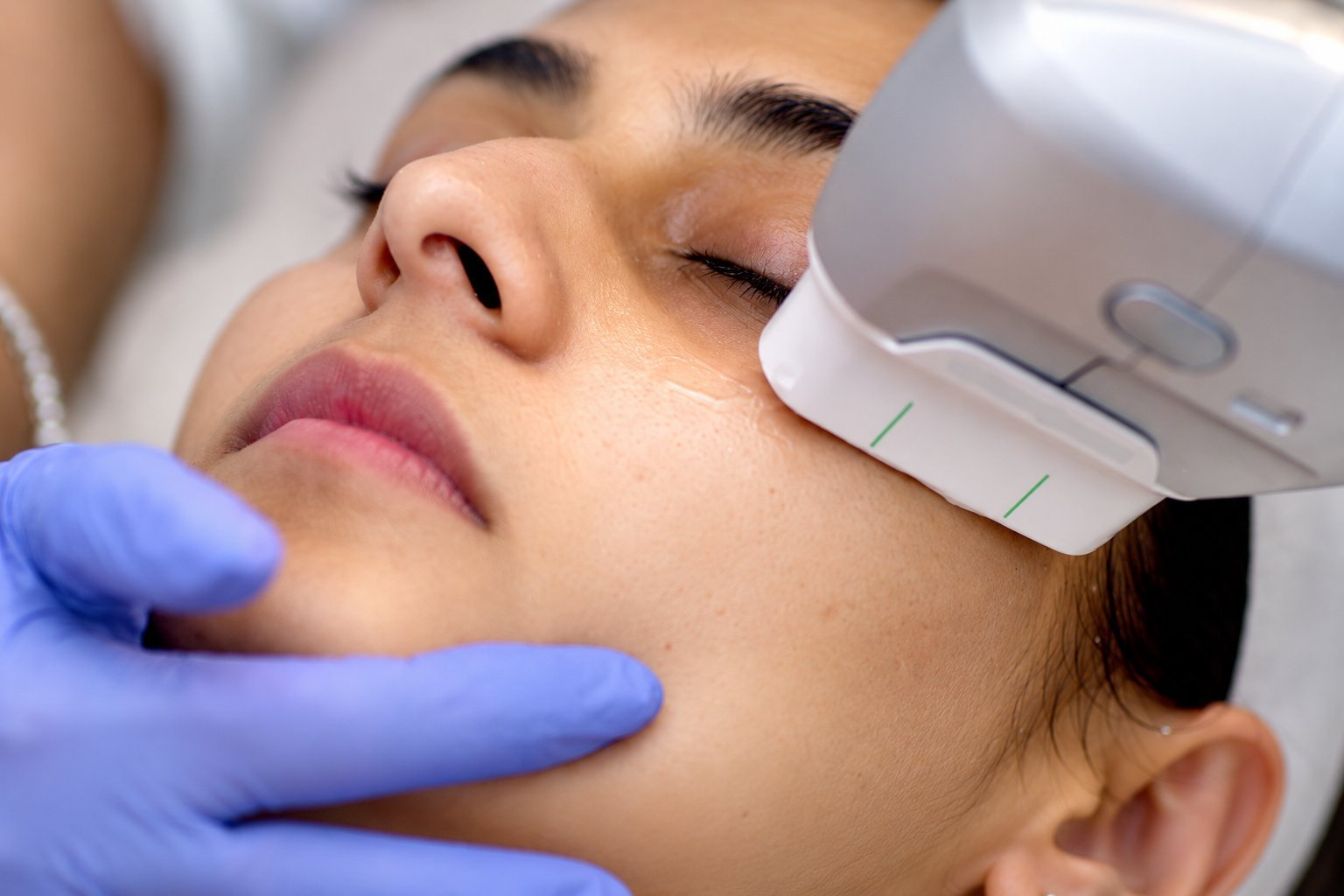 HIFU Skin Tightening: Who It Suits, Results & What to Expect