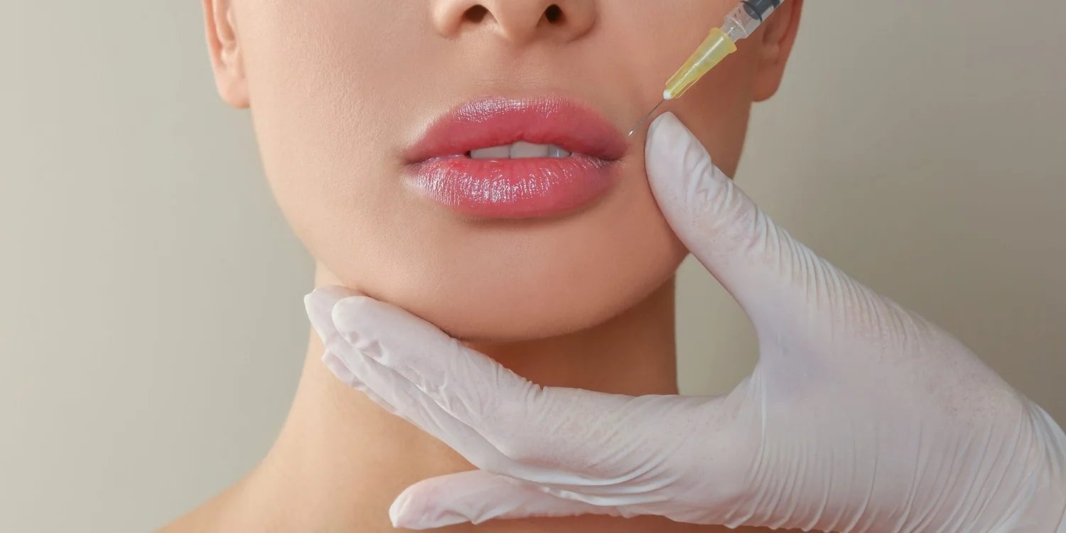 Lip Fillers: How to Get Natural-Looking Results