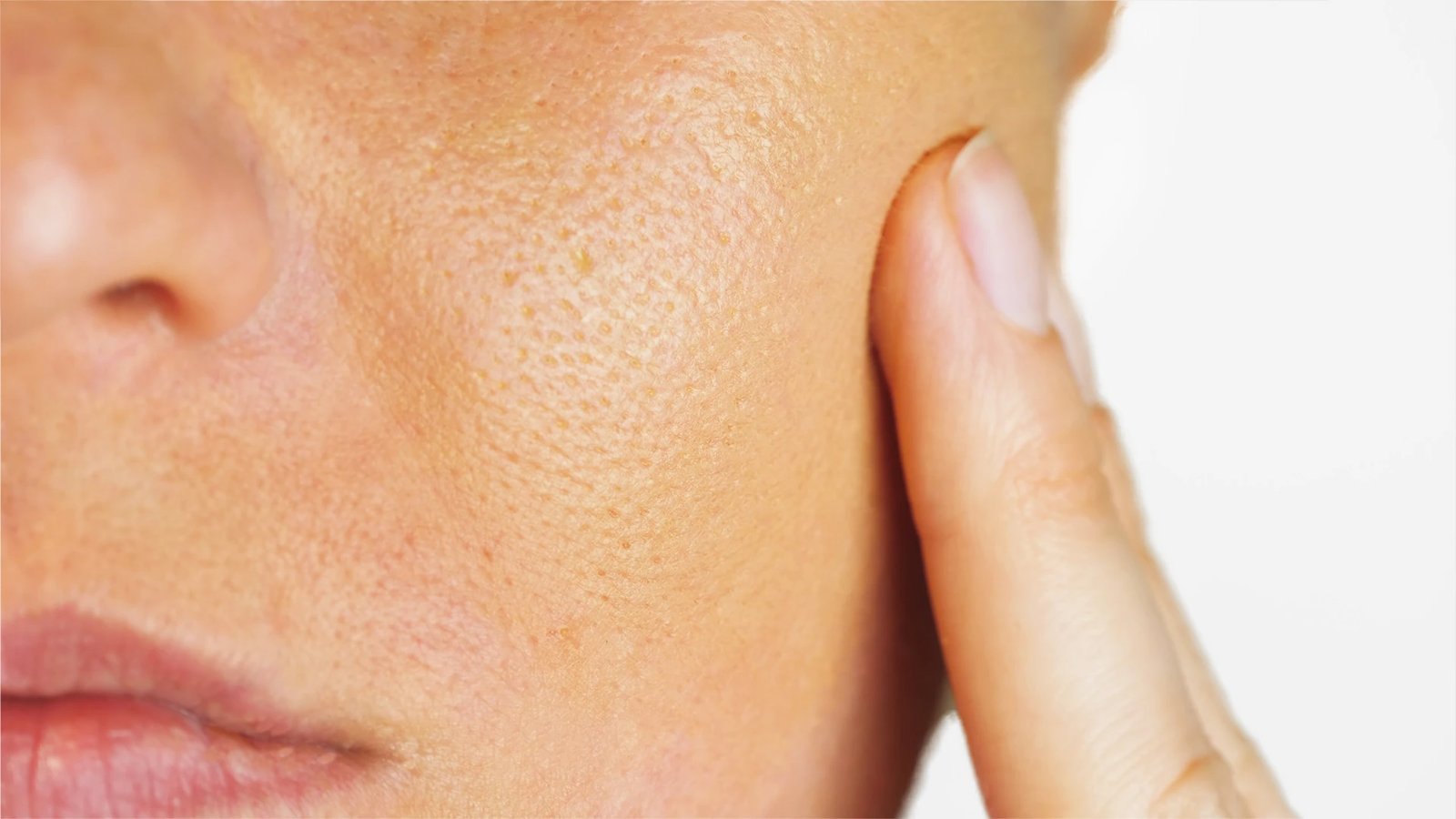 Open Pores on Indian Skin: What Shrinks Them (and What Doesn’t)